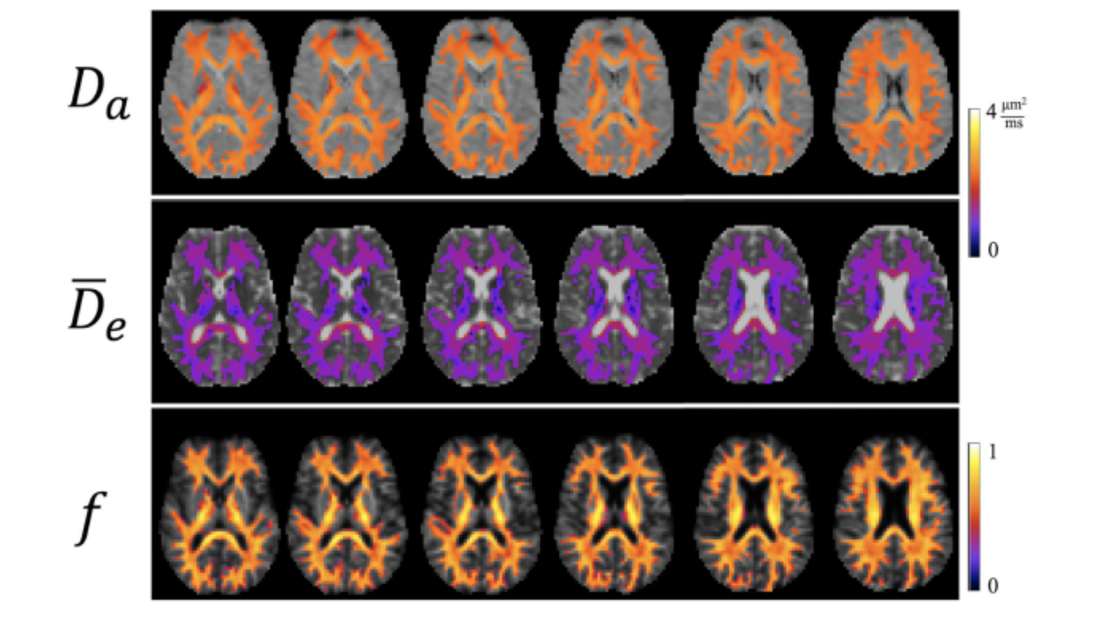 Advanced dMRI